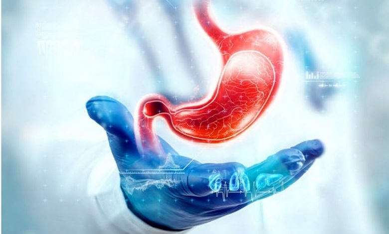 بیمه تکمیلی اسلیو معده