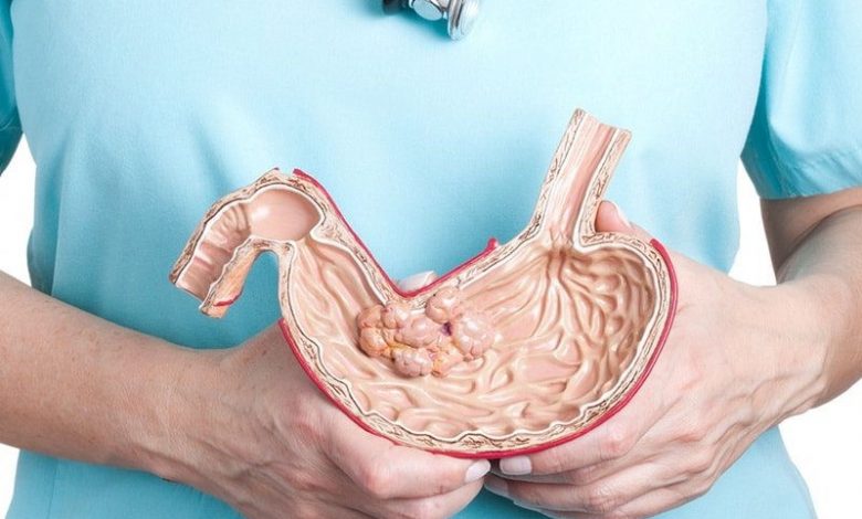 جراحی چاقی با بیمه تامین اجتماعی