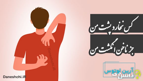 کس نخارد پشت من جز ناخن انگشت من
