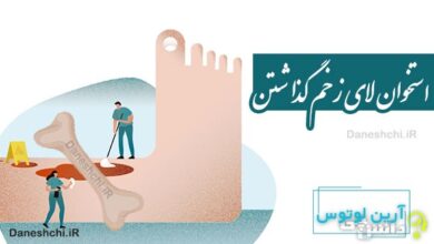 استخوان لای زخم گذاشتن