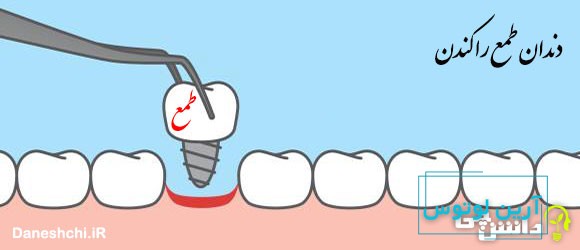 ضرب المثل دندان طمع را کندن