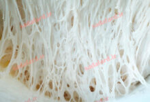 گلوتن چیست ؟