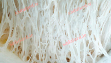 گلوتن چیست ؟