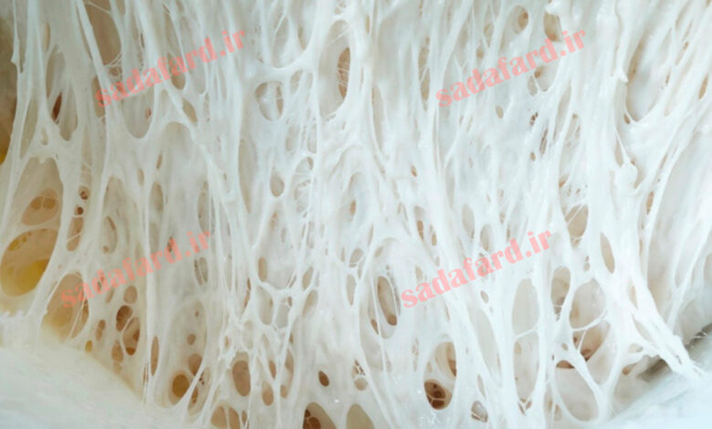 گلوتن چیست ؟