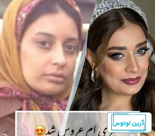 «گلپری» سریال آوای باران بعد ۱۱ سال در ۳۴ سالگی + عکس های تغییرات فوق جذاب!
